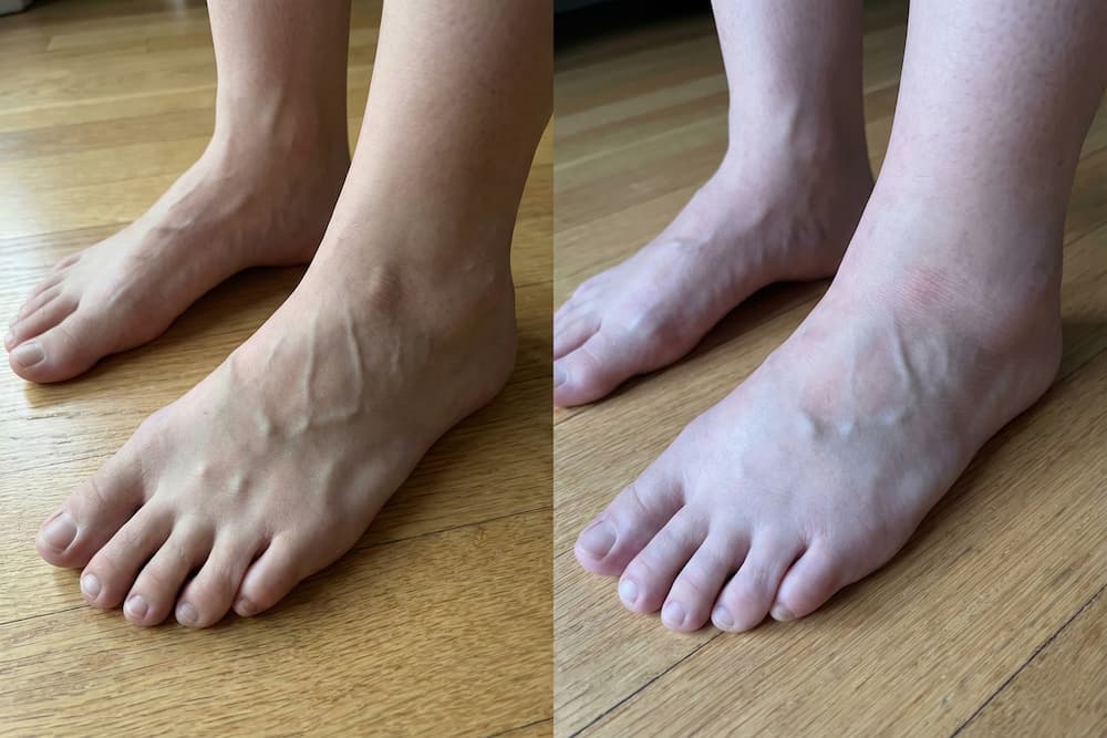 Et splitbillede af bare fødder på et trægulv, der sammenligner fodens volumen morgen og eftermiddag. Til venstre ses fødderne slanke med tydelige sener og blodårer, mens de til højre fremstår mere hævede og fyldige med udviskede konturer, hvilket illustrerer, hvor meget fødder kan udvide sig i løbet af en dag.