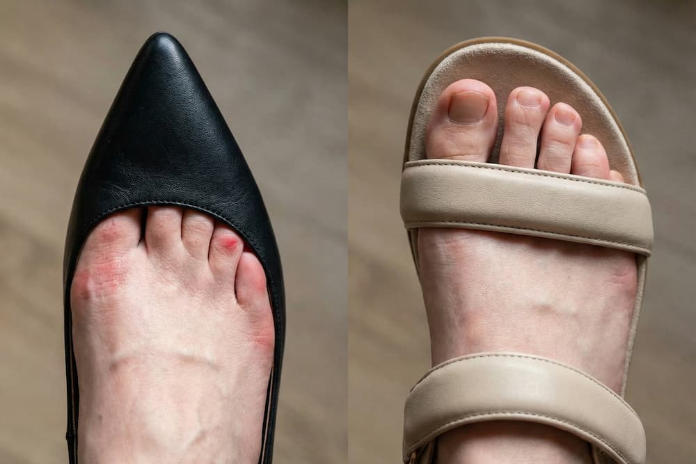 Nærbillede af to fødder; venstre fod har en sort højhælet sko på, og højre fod har en afslappet sandal med krydsende stropper og jeans på.